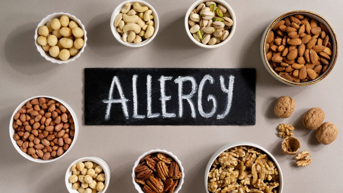 Der Alltag mit Allergien – auf diese Punkte müssen Betroffene bei Lebensmitteln achten